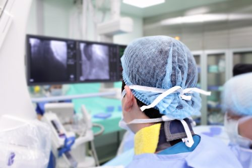 Angiografie