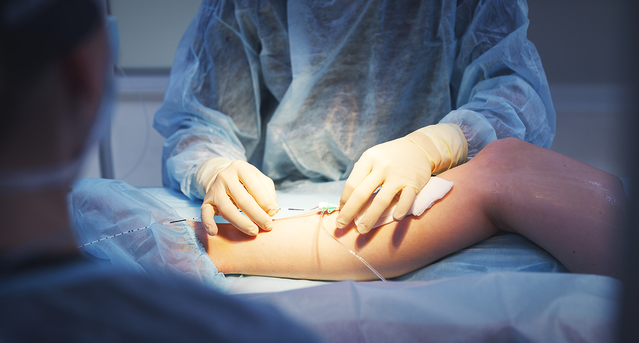 Periphere arterielle Verschlusskrankheit