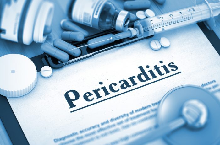 Die Perimyokarditis besteht aus zwei gleichzeitig auftretenden Erkrankungen: der Myokarditis und der Perikarditis.