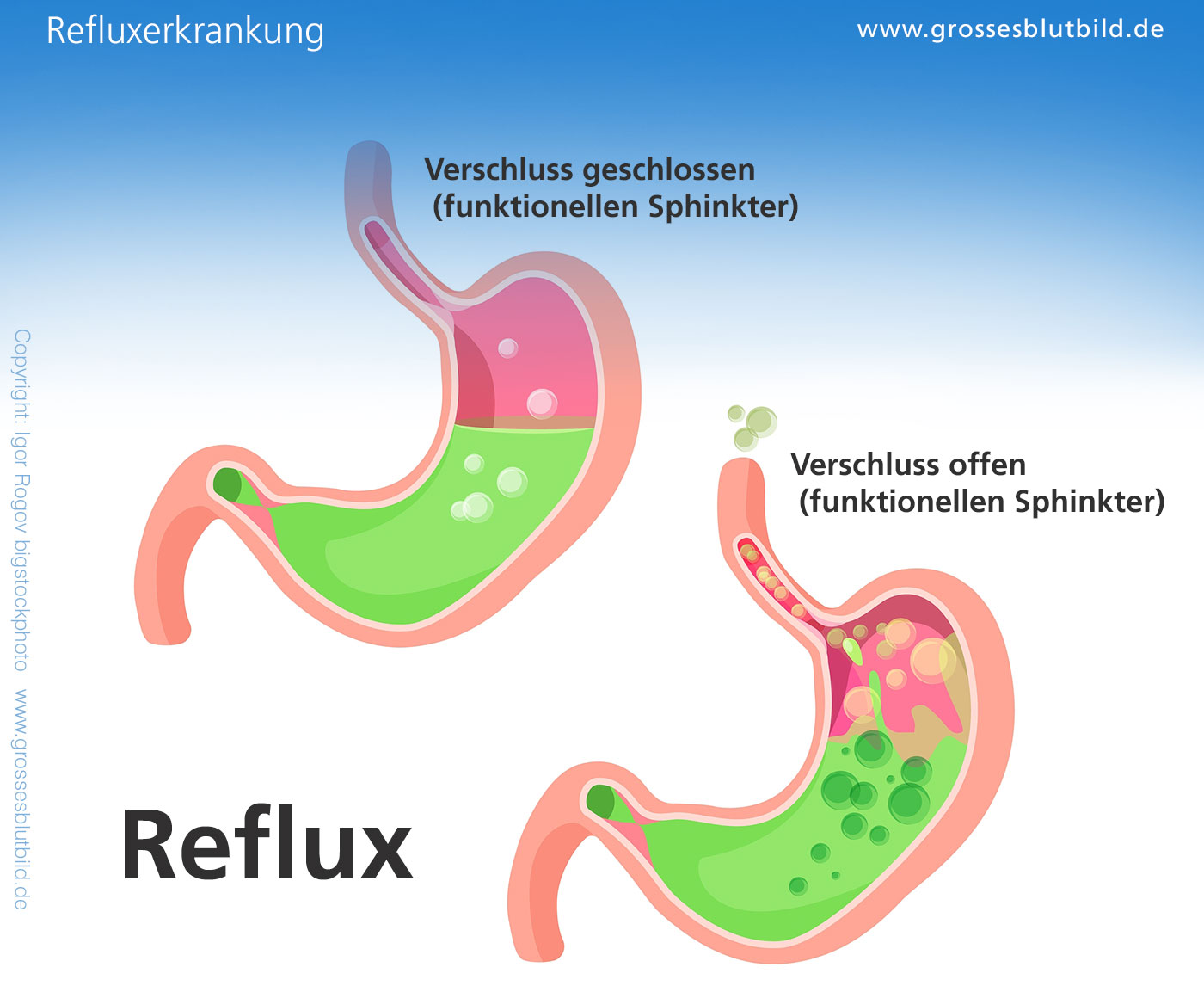 Stechen rechte seite double helix