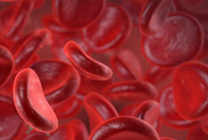 Erhöhte Eisenwerte im Blut - Hämochromatose - Ursachen, Symptome: